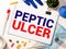 Doctor keeps a card with the name of the diagnosis -peptic ulcer. Selective focus