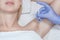 The doctor makes intramuscular injections of botulinum toxin in the underarm area