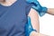 Doctor or nurse examine tuberculosis vaccine BCG marks on the shoulder of an adult woman made in childhood