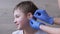 Doctor Otolaryngologist Cleans Ears, Ear Canal of a Child with a Cotton Swab