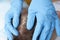 Doctor in protective gloves examining skin on patients head closeup