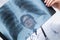 Doctor\'s face behind x-ray