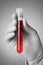 Doctor\'s hand with blood sample