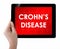 Doctor showing tablet with CROHNS DISEASE text.