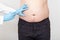 Doctor specialist makes slimming injections into the patient`s fat belly. Concept fat burning injections, lipolytic