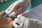 Doctor takes blood sample from a patient\'s finger using a capill