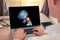 Doctor watching a x-ray of skull with pain in the neck on a laptop. Migraine headache or trauma concept. Radiology concept