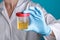 A doctor in a white coat and blue gloves holds a plastic can of urine in hand. urine tests virus, pregnancy, diseases