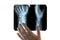 A doctor in white gloves examines an X-ray of a damaged hand. Close-up. Concept on a medical theme, day of radiologist or surgeon