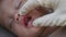 doctors hands check sleeping baby infant first milk teething in gums dentition