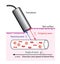 Doppler blood flow measurement