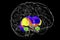 Dorsal striatum and lateral ventricles in the Huntington's disease, 3D illustration