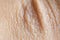 Dry and wrinkled skin on the human body, macro. Background, dermatology and cosmetology, copy space