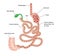 Duodenal switch bariatric surgery