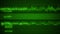 E.C.G. Cardiac impulse sequence on medical monitor