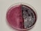 E. coli bacteria growing on blood and Macconkey agar