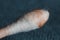 Earwax on a cotton swab, macro photo. Earwax, also known by the medical term cerumen, is a brown, orange, red, yellowish or gray