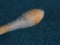 Earwax on a cotton swab, macro photo. Earwax, also known by the medical term cerumen, is a brown, orange, red, yellowish or gray