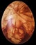 Easter Egg Decorated With Red Dye And Leaves Imprints Isolated On Black Background