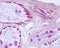 Eccrine sweat gland. Myoepithelial cells