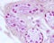 Eccrine sweat gland. Myoepithelial cells