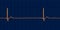ECG of 3rd degree AV block, 3D illustration
