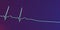 ECG in asystole, 3D illustration