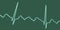 ECG in atrial flutter, 3D illustration