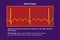 ECG in atrial flutter, an abnormal heart rhythm characterized by rapid, regular contractions of the atria, 3D