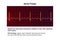 ECG in atrial flutter, an abnormal heart rhythm characterized by rapid, regular contractions of the atria, 3D