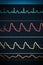 ECG chart on the monitor around the clock surveillance