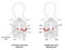 ECG chest leads