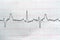 ECG ElectroCardioGraph paper that shows Normal Sinus Rhythm NSR with frequent PACs Premature Atrial Contractions, PVCs Premature