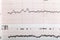 Ecg graph