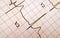 ECG output printout of a Heart rate or pulse wave measurement equipment in a hospital