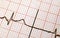 ECG output printout of a Heart rate or pulse wave measurement equipment in a hospital