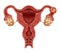 Ectopic Pregnancy