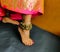 Eczema skin disorder girl wearing anklets