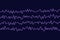 EEG Electroencephalogram, brain wave in awake state during rest