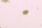 Egg of Hookworm in human stool