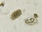 Eggs of Hookworm in stool