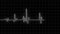 EKG 60 BPM Loop Screen white. Heartbeat waves showing healthy heartbeat and loose of heartbeat. More color options in my