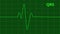 EKG Heartbeat on Monitor Recording of Pulse green line Rendered HD video