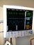 EKG, Pulse, BP and Respiration ICU Monitor Screen