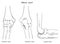 Elbow joint anatomy anterior posterior and lateral views