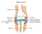 Elbow joint anatomy infographic diagram