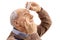 Elderly man applying eye drops