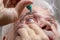 Elderly man buries medicine in his eyes