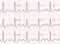 Electrocardiogram