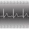 Electrocardiogram